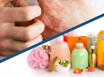Dermatite de Contato à metilisotiazolinona - Blog Dra Izabella Rached