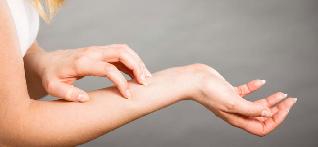 Alergia à picada de mosquito