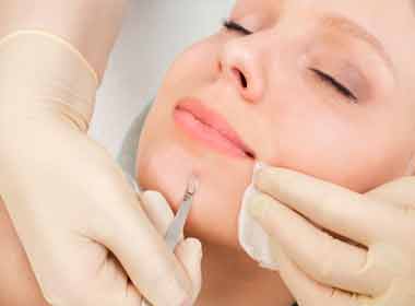 Dermatologia Cirúrgica procedimento de curetagem