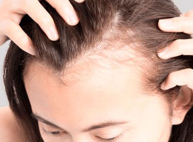 Tratamento para micose couro cabeludo