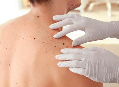 Dermatologia Clínica Tratamento contra sinais na pele