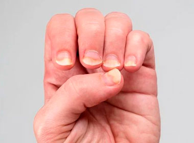 tratamento para alteração nas unhas