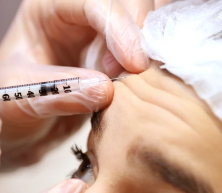 Toxina Botulínica (botox) em são paulo