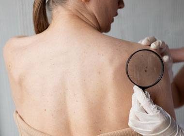thumb-dermatologia-clínica Capa Dermatologia clínica - dra Izabella Rached